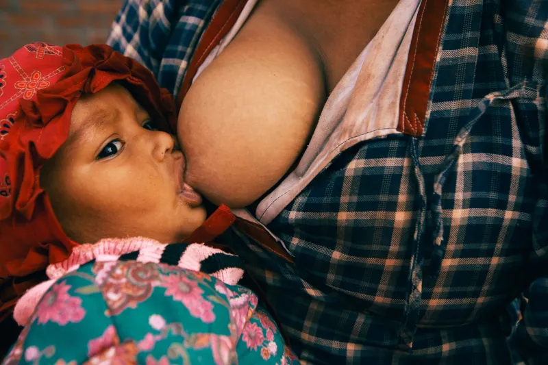 That Tiny White Dot Is Ruining Every Feed: The Truth About Milk Blisters